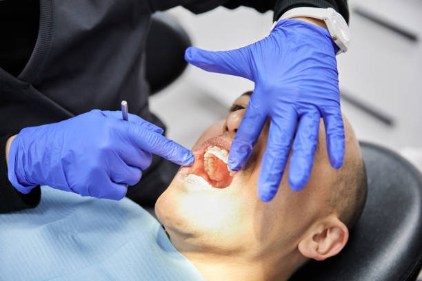 Best Broken or Chipped Tooth Repair in Brownsville, OR